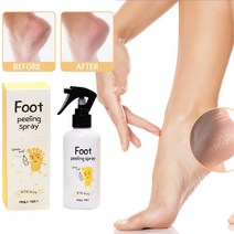 Eelhoe 1+1 발 뒤꿈치 갈라짐 뒤꿈치 각질제거 발바닥 굳은살 분무하다, 200ml