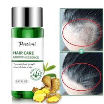 탈모약 탈모치료제 프로페시아 바르는 먹는탈모약 탈모샴푸 두피모낭염 hair growth essential oil for woman fast promo 헤어 성장 에센스 방지