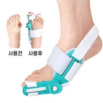 발가락 교정기 무지외반증교정기 엄지손가락교정기, 그레이, 2개