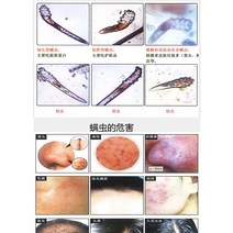 두피진단기 디지털현미경 휴대용 현미경 고화질 진드기 탐지기 미용실 테스트 두피 광학 기기 관찰 얼굴 피부, [02] 하얀색