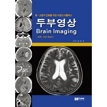 중 고령자 진료를 위한 뇌영상 아틀라스 두부영상(Brain Imaging):판독 진단 테크닉, 닥터스북, 강효석 저