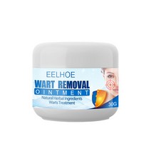 Bestevery 30g 사마귀 제거 크림 바디 스킨 케어 리무버 연고, 1개