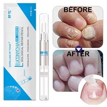 손톤영양제 손톱강화제 큐티클오일 손톱갈라짐 3 ml 네일 리페어 액체 펜 브러시 안티, 3ml