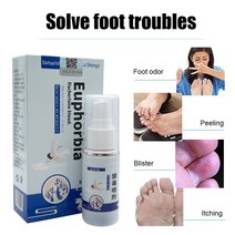 항균 건선 스프레이 가려움증 습진 드레싱 피부 발진 두드러기 모기 물림 박리 건강 관리, 없음