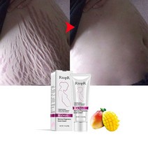 Bestevery 흉터 여드름 리무버 크림 망고 임신 제거 스트레치 마크 치료, 1개