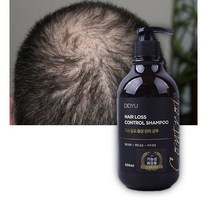 출산후 탈모샴푸 m자 원형 탈모 머리 빠짐 건성 두피 지루성피부염 얇은 머리카락 샴푸