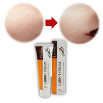 피부색소침착 반점제거 크림 2개 미백 연고 목주름지우개 눈밑주름 없애는법 미간주름 제거