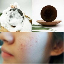 [거품망 증정] 고농축 어성초 비누 사춘기 청소년 얼굴 고농축 어성초 좁쌀 여드름비누 모낭 세안비누 농축어성초비누 세수비누 YB맘, 1개, 100g