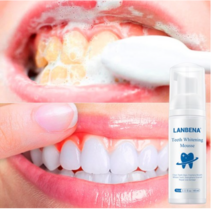 Lanbena 치아 화이트닝 무스 치아 화이트닝 화이트 치아 구강 위생 치약 표백 얼룩 제거 치과 도구, 1개