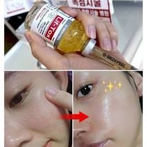 ﻿실리프팅 필러주름앰플 30ml/주름골 콜라겐 안티에이징 ﻿, 5)윤곽 실리프팅 주름골앰플1개 아이보톡 크림 1+1개
