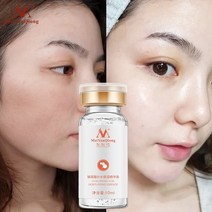 에센스 세럼 히알루론산 페이셜 모이스처라이징 화이트닝 에이징 케어 미세 모공 퍼밍 워터, 없음