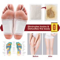 발바닥 패치 발독소 발 파스 뽀송 힐링 발파스 릴렉스 수액 노폐물 독소생강 쑥 해독 발 패치 대나무 패드, 01 10pcs