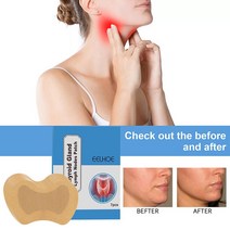 림프마사지기 괄사 경락 순환 안마용품 림프 관리 패치 목 지방 연소 혈액 마사지 방지 부종 스티커 Thyroid 치료 석고 7 개