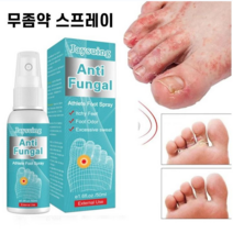 무좀 치료 발가려움 스프레이 에센스 항감염 무좀치료제 풋 케어 세럼, 50ml, 1개, 1개