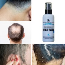 마라세지아펄펄 항균검사 받은 킬투버즈 유산균 두피로션, 1개