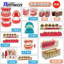 치아 모형 재료상 입모형 칫솔질 모형 치아 치과 충치 교구 치아모델 구강모델 치과표준 치아, 02 1호 프리미엄 리페어 모델 1개