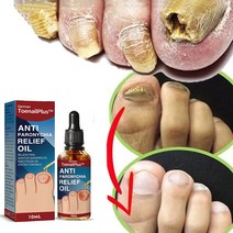 발톱무좀치료 발톱무좀연고 리페어 에센스, 10ml, 1개