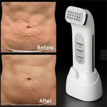 고주파 치료기 온열 초음파 미세 전류 마사지 가정용 리얼 주름 제거 도트 매트릭스 페이셜 열처리 무선 주파수 리프팅 페이스 리프트 바디 스킨 케어 뷰티 디바이스, 없음, 한개옵션0