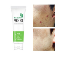 1+1 에스알픽 트러블 자국 각질 모공수축 티트리폭탄 폼클렌징 120ml, 9세트