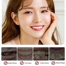 치아미백 셀프 도구 위생 얼룩 펜 누런이빨 칫솔 화이트닝겔 로타리 치과 청소 치아 젤 플라크 기계, 02=2pcs