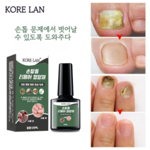 발톱무좀 리페어 에센스 천연 항진균제 발톱강화제 패디세이버 문제성 손톱 발톱 케어, 20ml × 2개, 2개, 20ml
