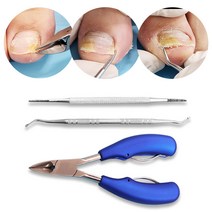 내성발톱자가치료 파고드는 발톱 무좀 문제성 관리 깎이 큐렛 샤퍼 니퍼 3종, 발톱관리3종세트