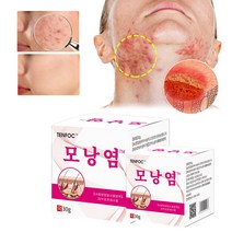 BT 피부가려움증 습진연고 지루성피부염 건선 크림 얼굴 여드름 연고, 1개, 30g