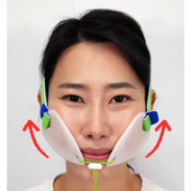 미소교정기 입꼬리올리기 볼리프팅 입벌림방지, 1개