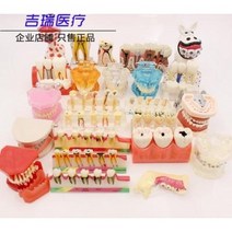 치아 모형 재료상 입모형 칫솔질 모형 치아 치과 충치 교구 치아모델 구강교습 교정재배모델, 01 4배 재배 모델