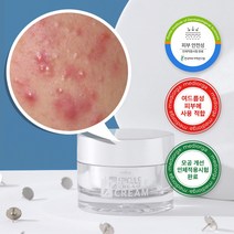 메디올가 데일리 얼굴 박피 각질 제거 트러블 좁쌀 여드름 수분 진정 피지 모공 축소 주름 미백 셀프케어 환생 바늘 스피큘 크림, 50ml X 2개