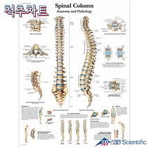 3B Scientific 척추차트 VR1152 Spinal Column 척추질병 병원액자