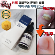[공식] 리뉴얼 닥터로운 셀라큐어 20mI 문제성 발톱 무좀 관리 셀라솔루션 닥터로운셀라큐어 문제성발톱 티트리 뉴리트리언트 믹스, 1개, 1개입