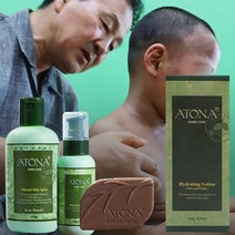 아토피 건선을 위한 천연비누 보습로션 세럼 스프레이 [아토나] 피부가려움증 없애줘요, 비누