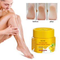 안티 드라이 크랙 풋 크림 힐 금이 간 리페어 바나나 오일 감염 제거 각질 보습 손 발 케어, 한개옵션1, 한개옵션0