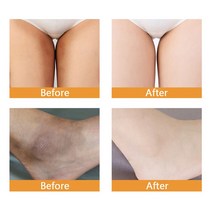 은밀한 부품을 위한 미백 크림 바디 무릎 팔꿈치 목 칙칙한 색소 제거 피부톤 밝고 균일한 스킨 케어 제품, 01 1pc