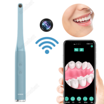 Smabat 무선 WiFi 구강 카메라 내시경 구강 치과 내시경 와이파이 화소 100만 1080P 6 LED 라이트 화이트 블랙 그린 블루