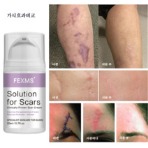 흉터제거연고 화상 상처 흉터 수술 상처 피부 흉터 치료