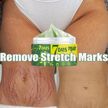 [크림] 스트레치 마크 제거 크림 출산 바디 케어 흉터 치료 안티 에이징 링클 스킨 1 개, [02] 50g