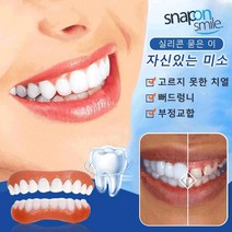 남녀공용 마우스피스세트 4세대 미백 실리콘 틀니, 미백 틀니(4세대 미백 틀니) ×2