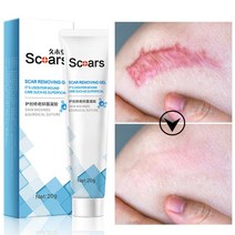 흉터 제거 크림 치료 여드름 화상 수술 제거제 스트레치 마크 젤 수리 부드러운 피부 보습 미백 뷰티 케어