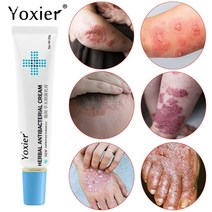 YAPOGI 릴리프 습진 피부염 두드러기 바디크림 허브 건선 항진균성 가려움증 크림, 2개
