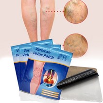 6pcs 정맥류 패치 혈관염 정맥염 중국어 의료 드레싱 거미 안티 붓기 제거 다리 케어 고약