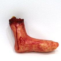 끊어진 발