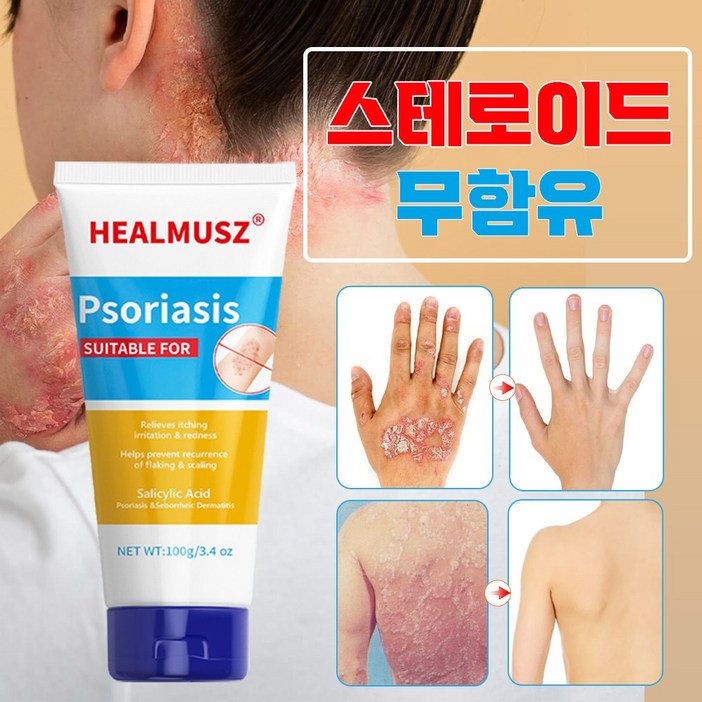 [당일배송]건선연고 완화 피부 가려움증 대상포진 지루성피부염 아토피 피부염 발진 피부 진정 크림 건선크림