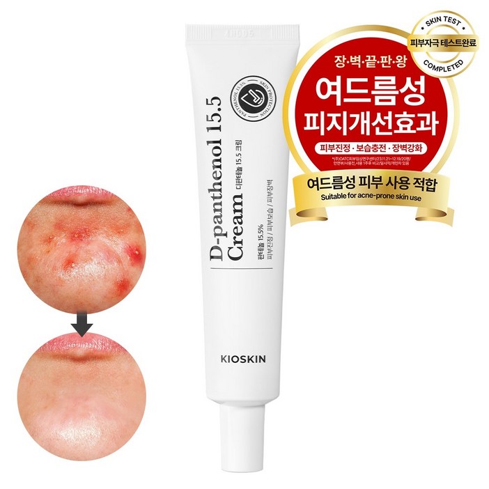 국내 유일 고함량 키오스킨 디판테놀 15.5 여드름크림 모공트러블 피지량감소 장벽개선 진정크림