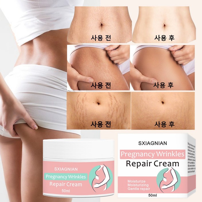 (한국셀러/본토출하)임산부 산전후 튼살 탄력케어 크림 흉터관리 임산부 청소년 이용가능