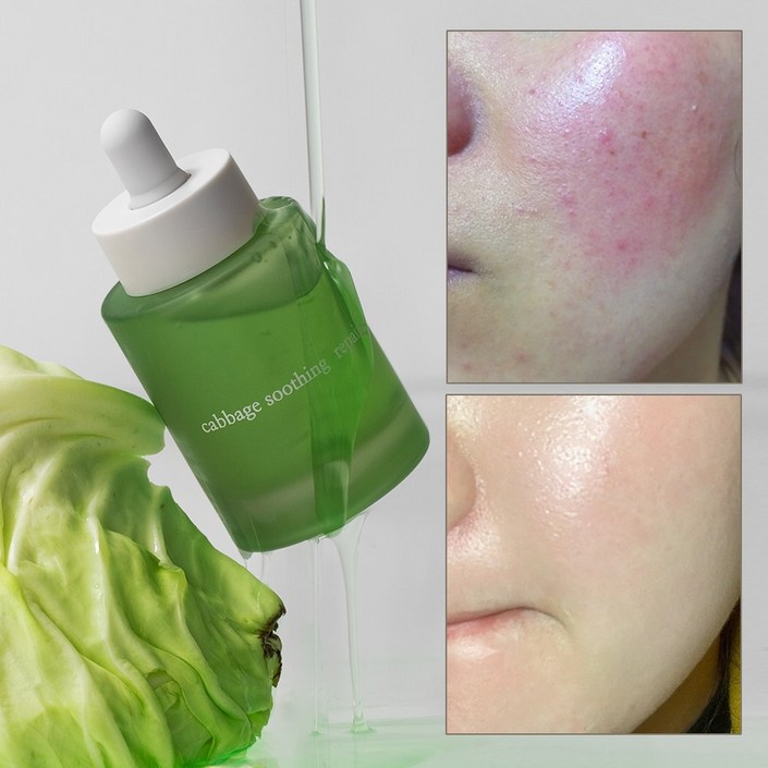 엘리메르 캐비지 수딩 리페어 세럼 에센스, 1개, 50ml