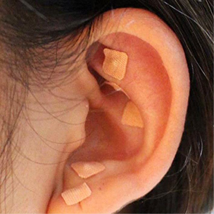 귀 지압패치 600개 1세트 하루혈자리 붙이는 경락 다이어트 지압 스티커 건강관리 지압점 패치