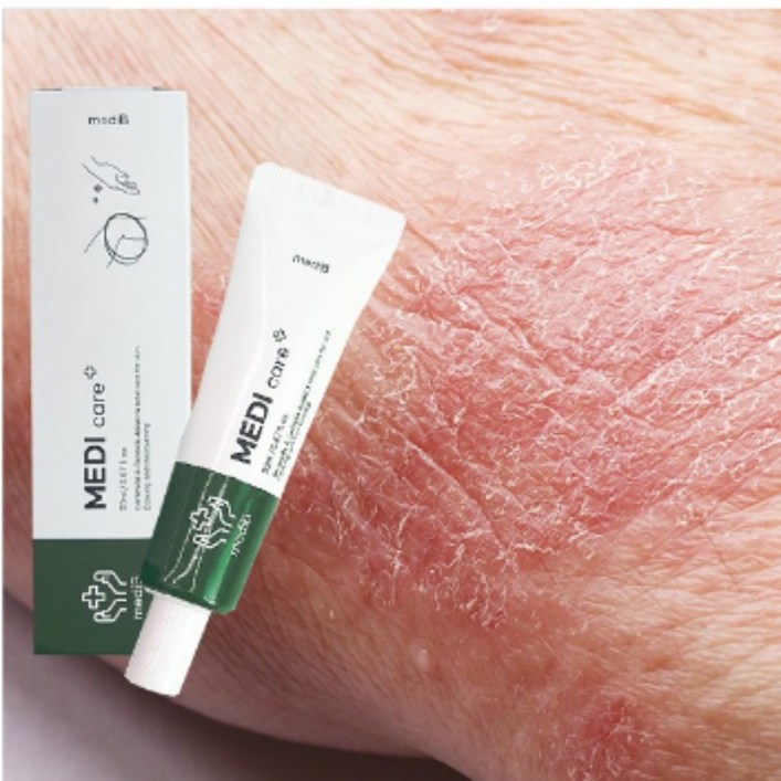 피부 연고 습진 크림 건조한 가려움 간지러움 건선 메디 케어 메디비