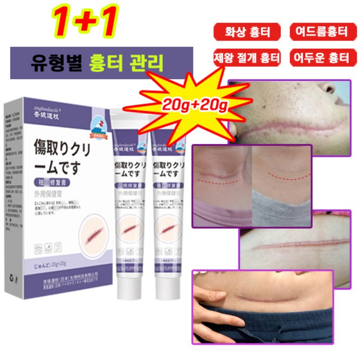 100제거당일배송  흉터제거연고 상처흉터연고 여드름 연고 민감한 피부를 수술 화상 제왕절개 수술흉터 연고
